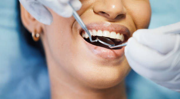 Best Emergency Dentist for Lost Fillings or Crowns in Home Garden, CA